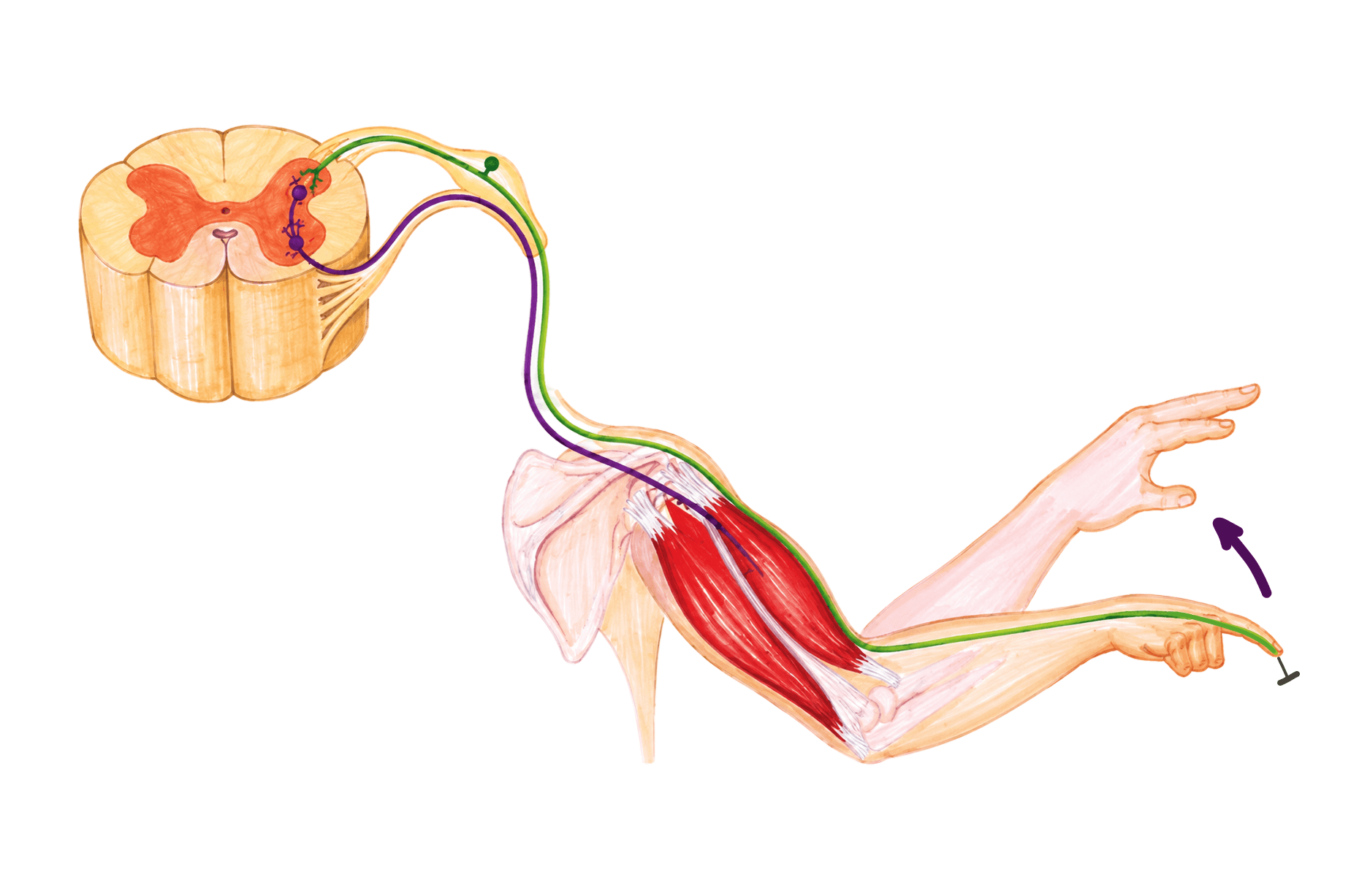Reflexul polisinaptic: reflexul nociceptiv